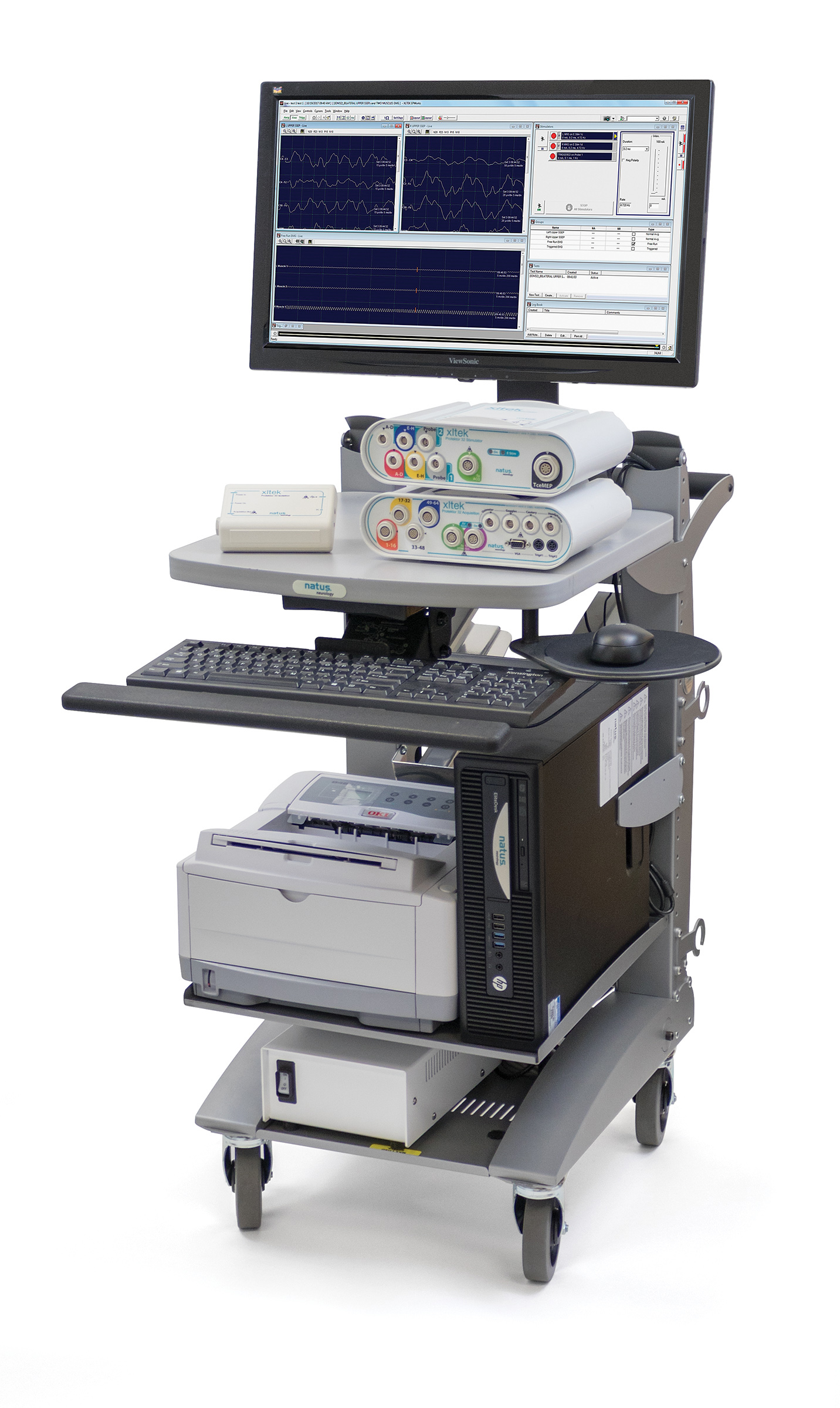 نوار عصب وعضله EMG